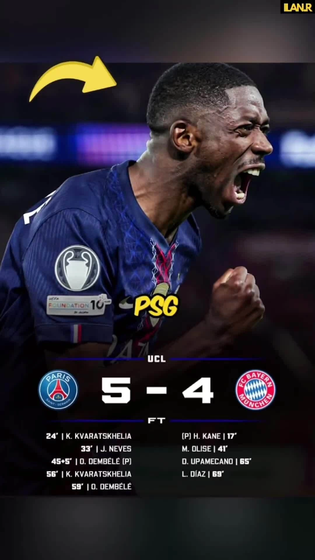 Diễn biến trận lượt đi bán kết Champions League tối 28/4, PSG 5-4 Bayern. Diễn biến trận lượt đi bán kết Champions League tối 28/4, PSG 5-4 Bayern.