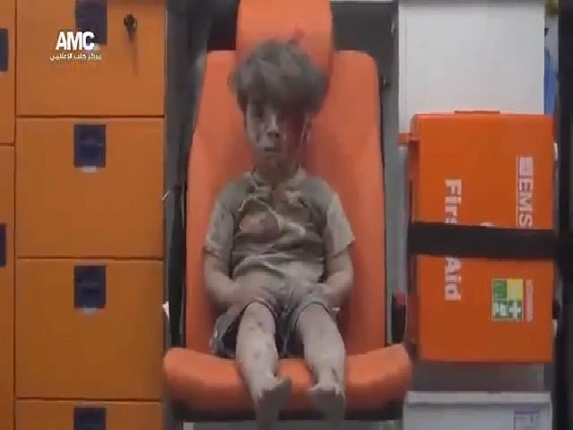Cậu bé Syria bị thương làm dậy sóng mạng xã hội